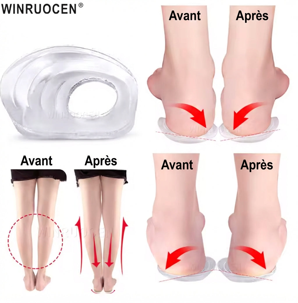 Semelles correctrices en gel silicone pour genoux O/X et pieds plats