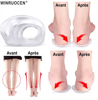 Semelles correctrices en gel silicone pour genoux O/X et pieds plats